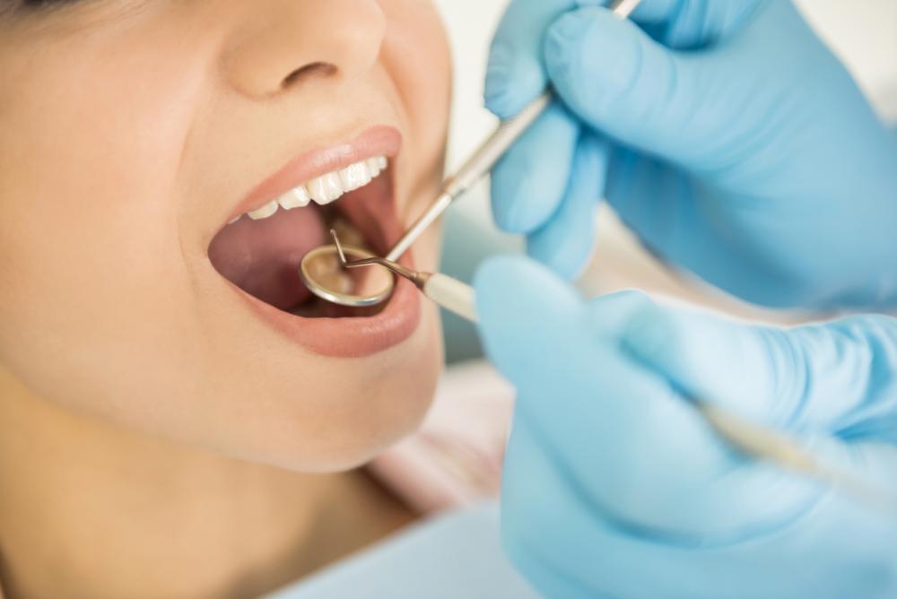 estetica dentara Tratamentele ortodontice, soluție practică de aliniere a dinților